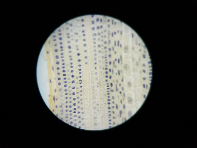 Onion Root Mitosis Slides - Onion Root  Mitosis  08 400X